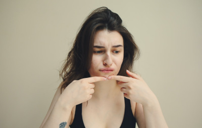 Routine beauté après l'été : soins anti-imperfections