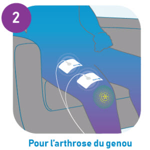 soulager l'arthrose du genou