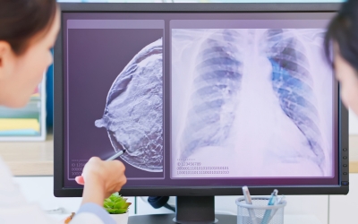 diagnostique d'un cancer du sein par un professionnel de santé