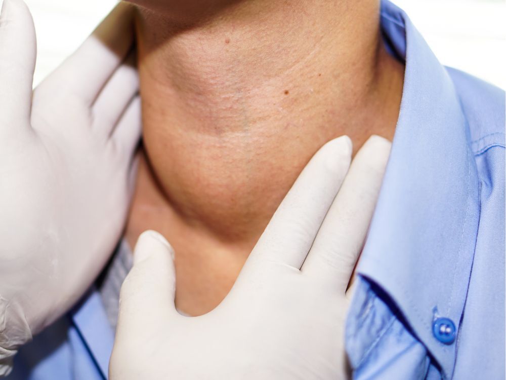 Hyperthyroïdie