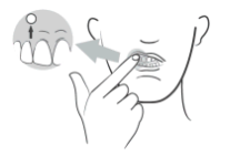 Schéma de mise en place du comprimé Virpax